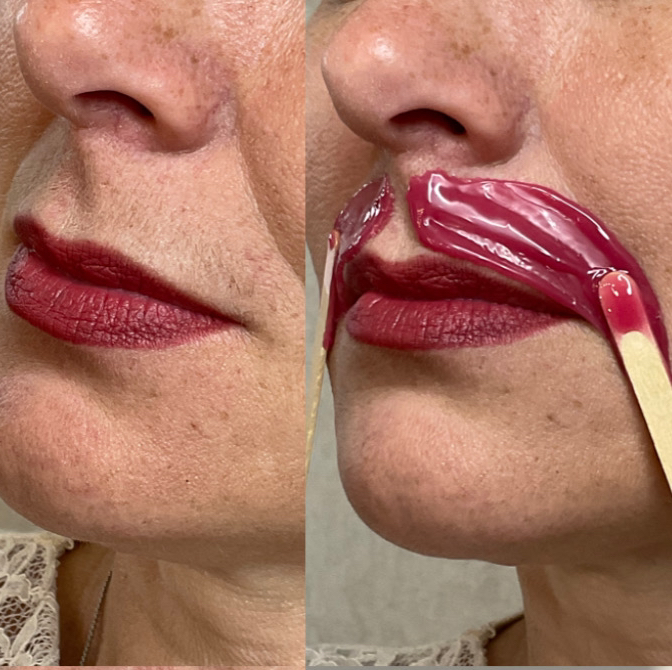 Коррекция воском одной зоны на лице( верхняя губа, подбородок, нос) только как доп.процедура в комплексе!