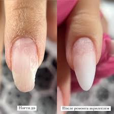 Ремонт ногтя