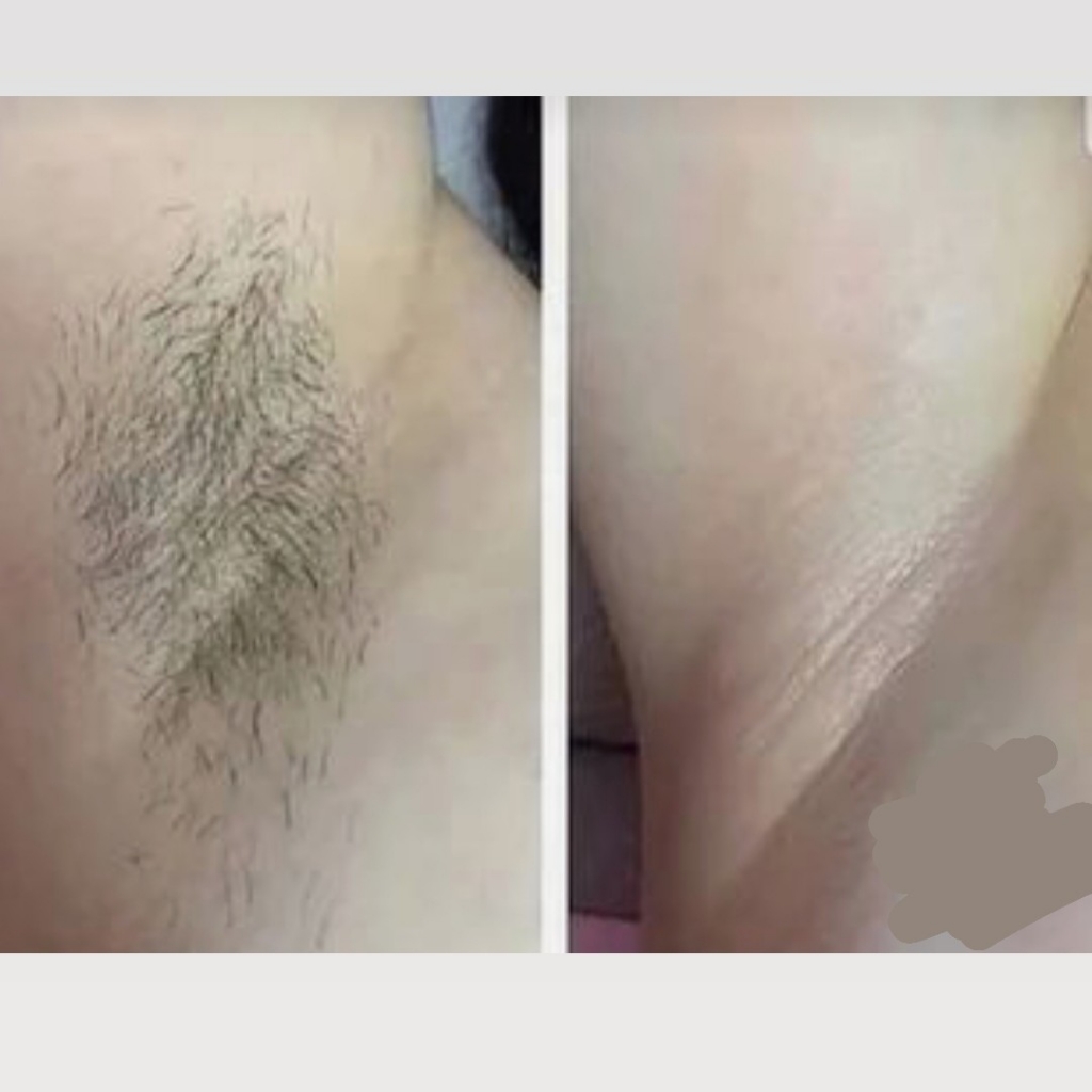 Подмышечные впадины