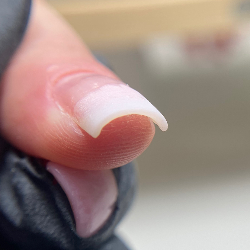 Ремонт/донаращивание