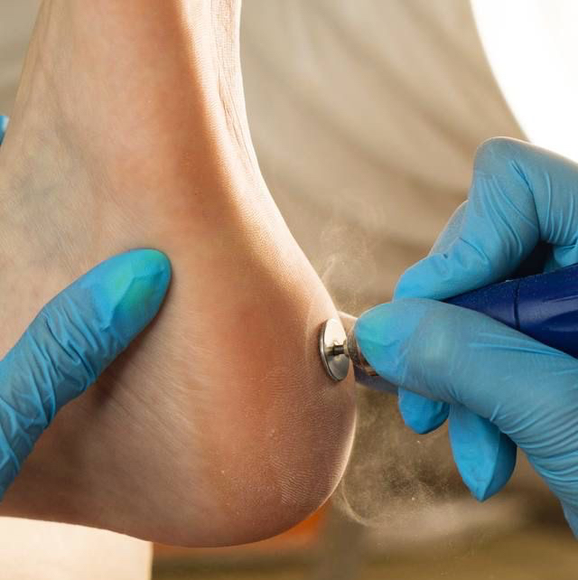 Обработка стоп