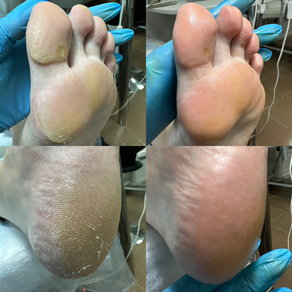 Обработка пятки и стопы(без обработки пальцев и без покрытия)