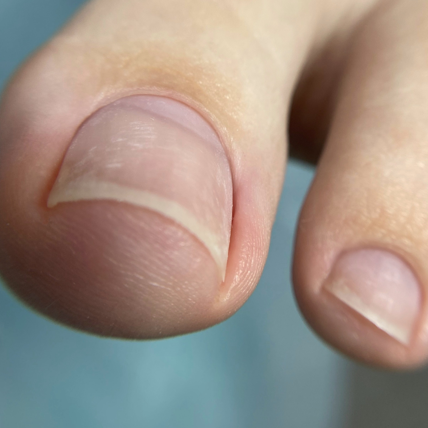 Гигиенический педикюр
(Здоровой стопы и ногтей)