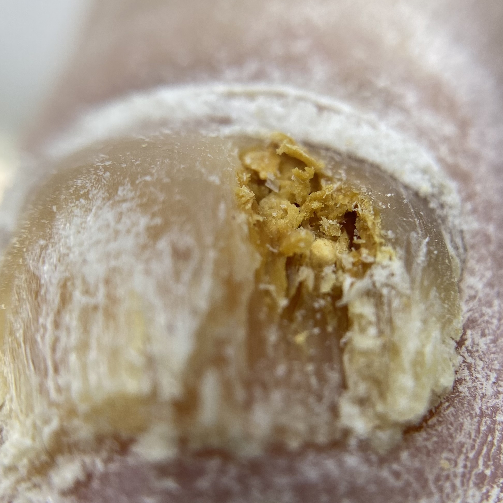 Онихомикоз (грибок)