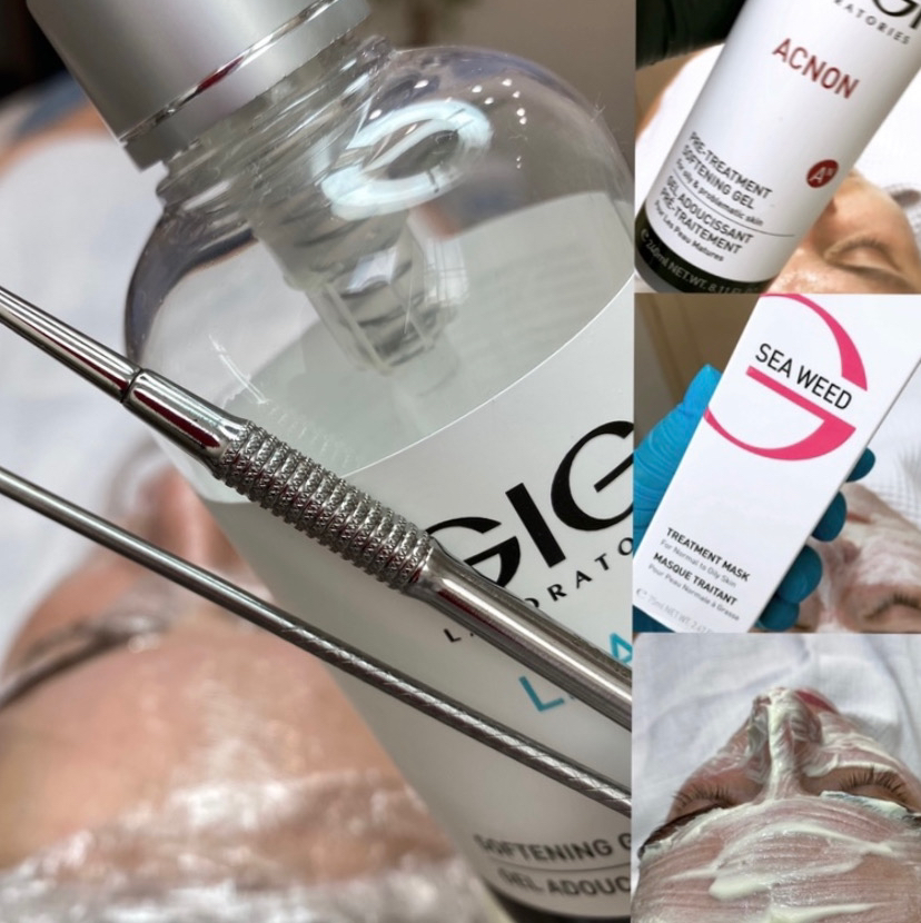 Чистка лица( гигиеническая )