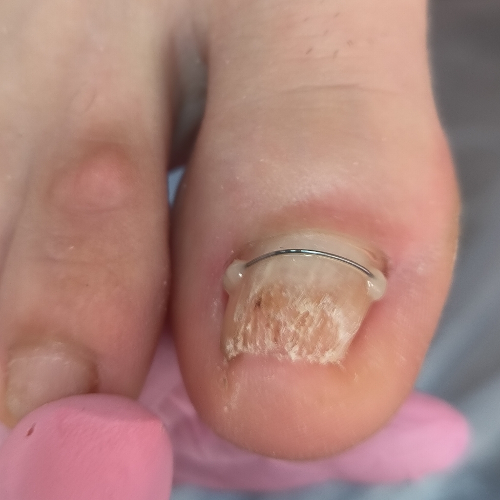 Коррекционная система