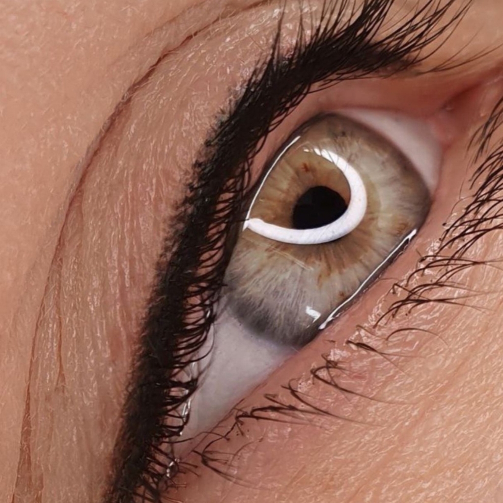 Межресничное пространство