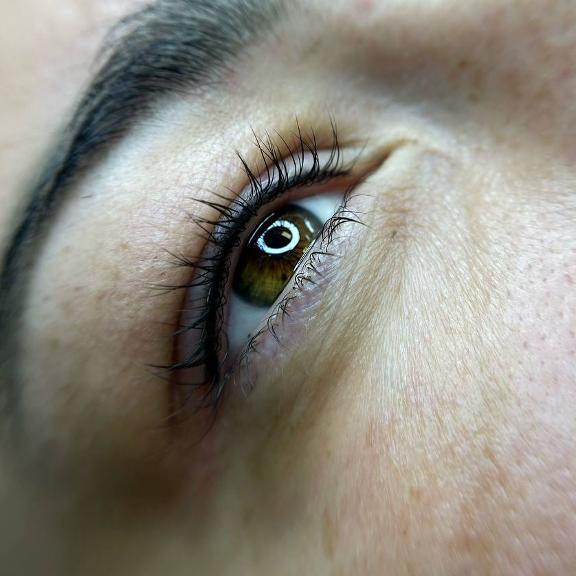 Межресничка