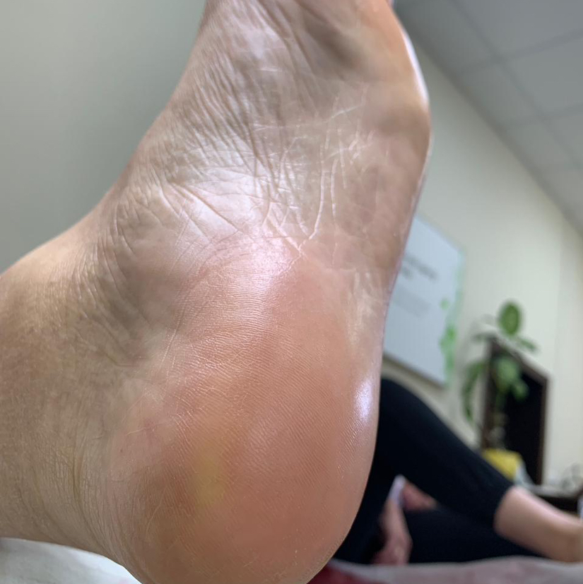 Гигиенический педикюр (Обработка стопы без покрытия)