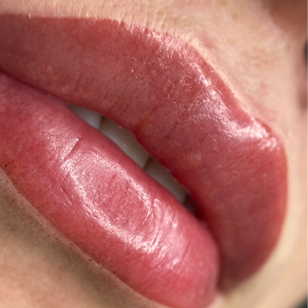 Коррекция напыления губ (вторичная процедура - через 1-1,5 мес.)