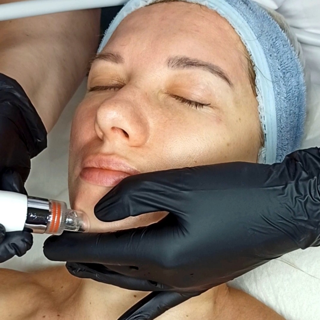Вакуумная чистка лица с сыворотками (hydrafacial)