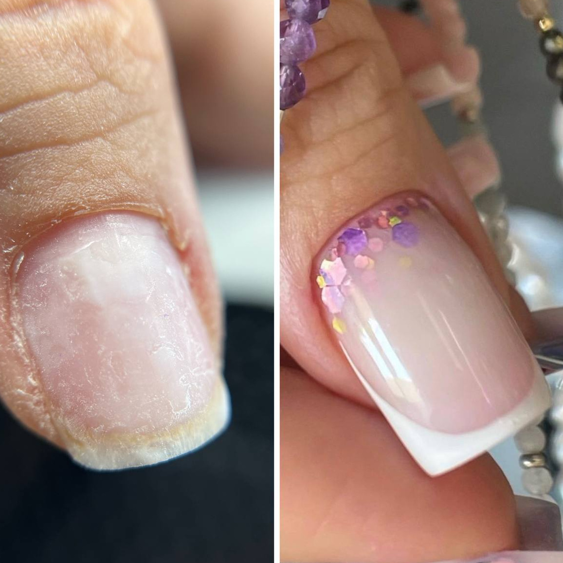Complex: Nail Extensions / Комплекс: Наращивание ногтей