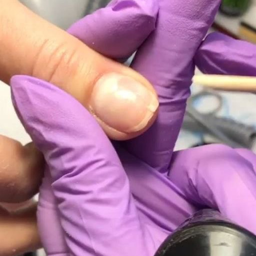 Nail repair / Ремонт ногтя
