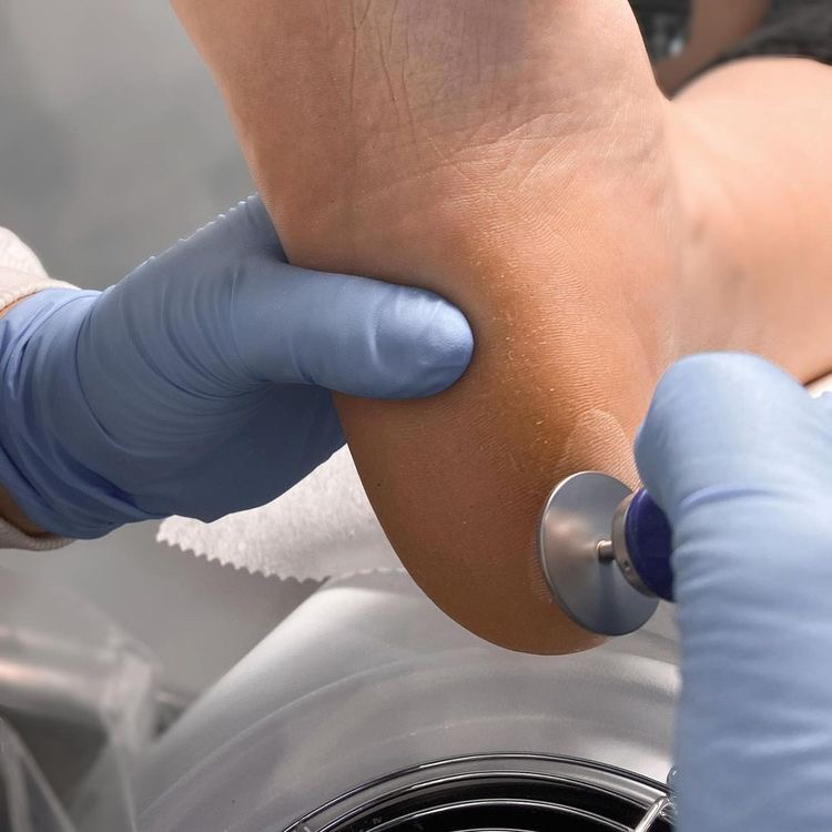 Обработка только стоп