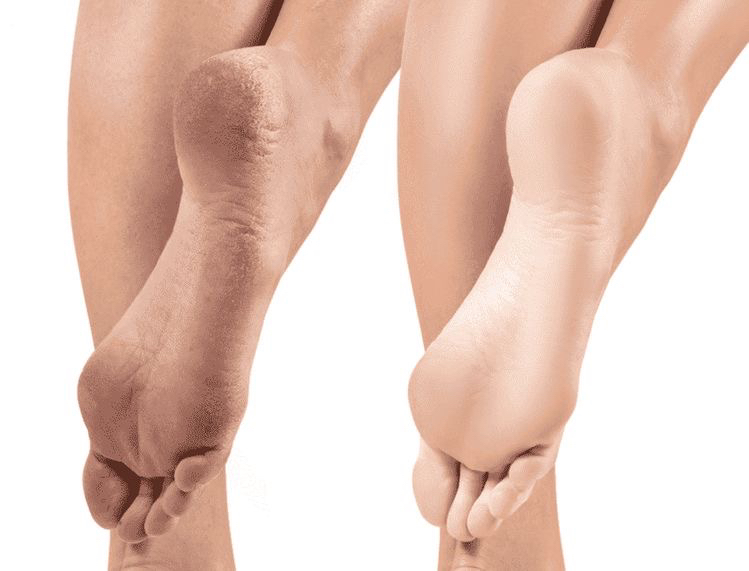 Полный педикюр без покрытия