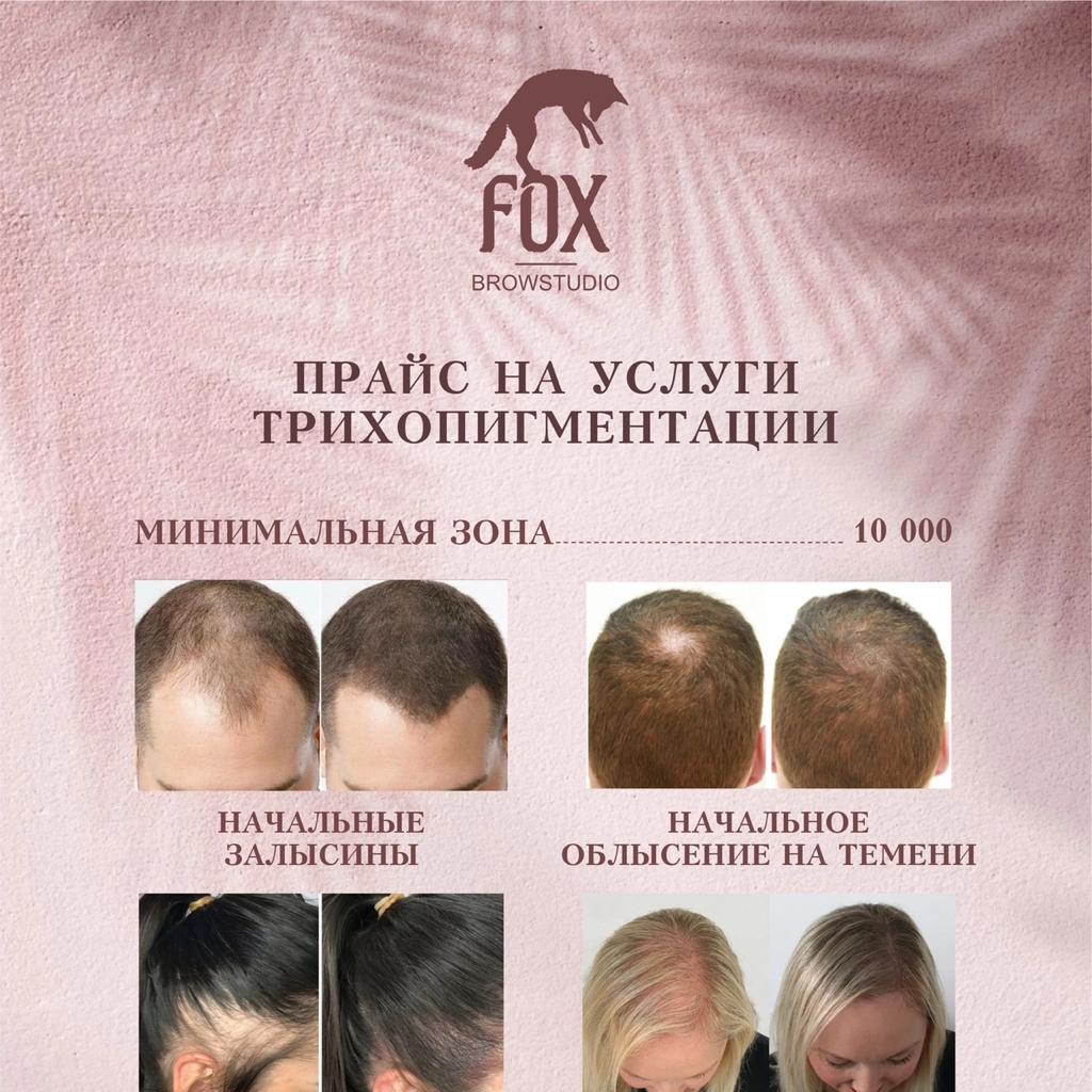 Дермопигментация головы Минимальная зона
