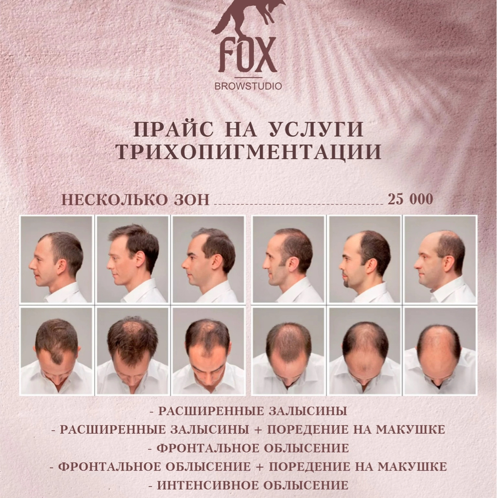 Дермопигментация головы Несколько зон.