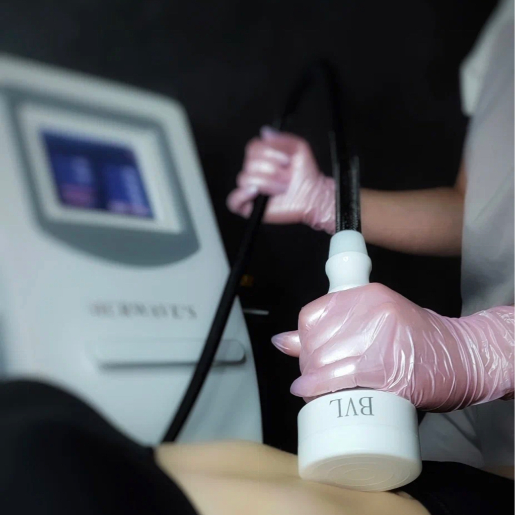 MC процедура