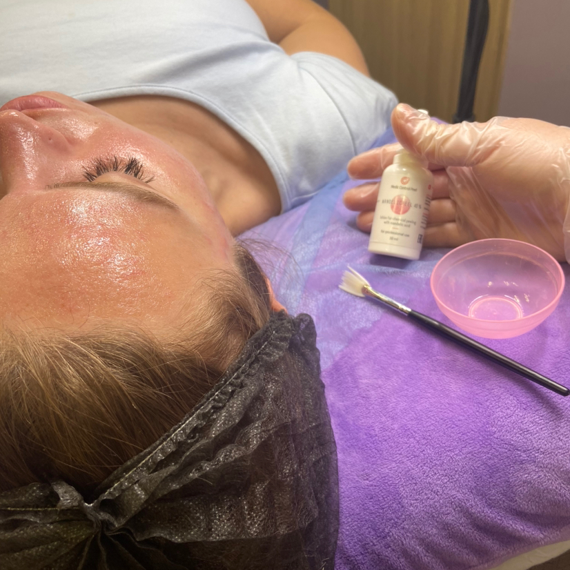 Авторская чистка лица + кислотный пилинг