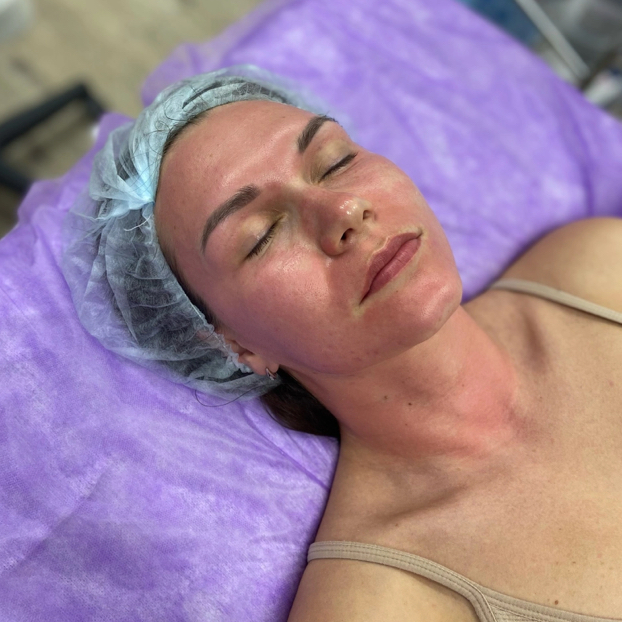 Фракционная мезотерапия (глаза + лицо + шея)