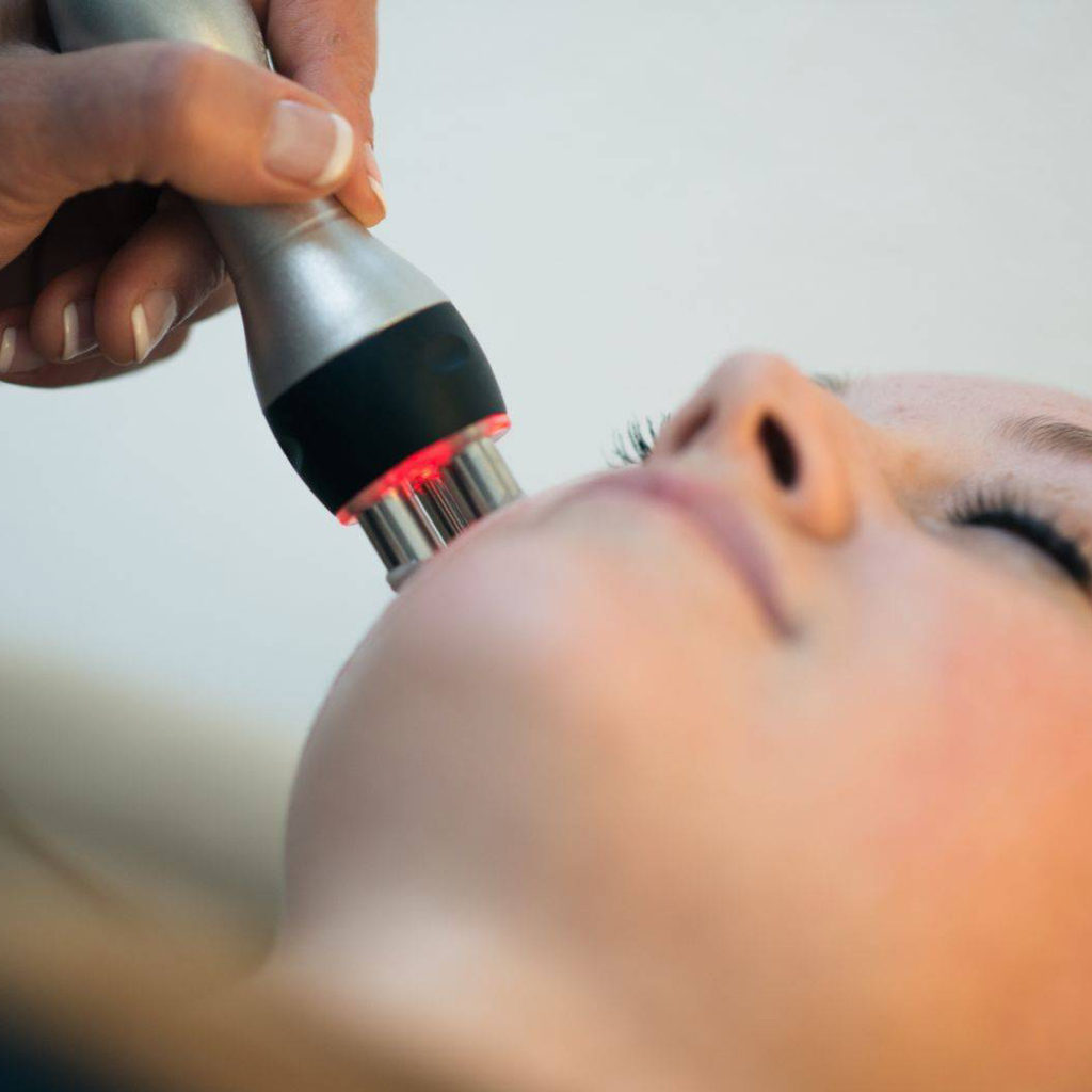 RF- лифтинг лица ( разовая процедура)