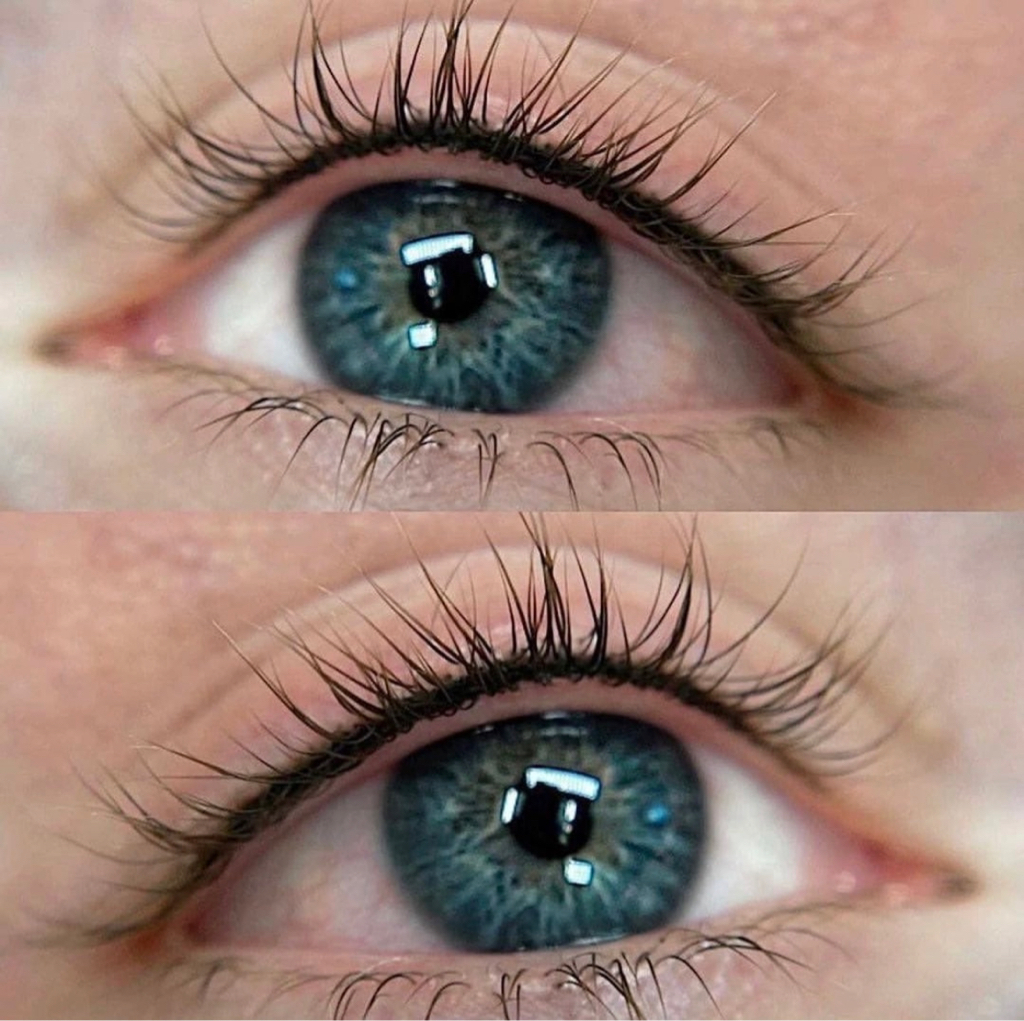 Межресничка/ ПМ