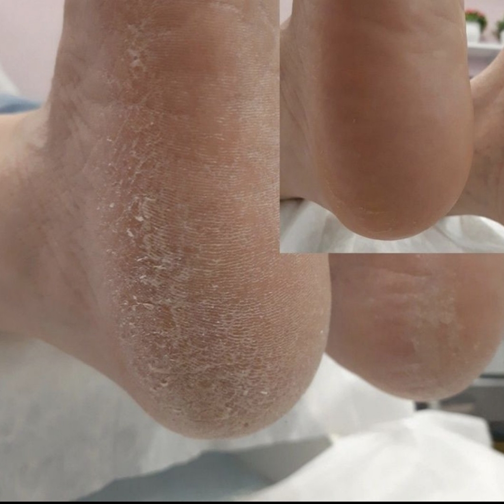 Педикюр без покрытия