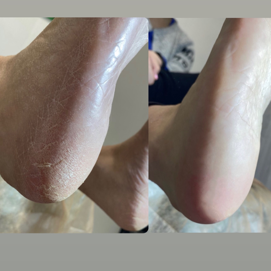 Педикюр с механической обработкой стопы без покрытия