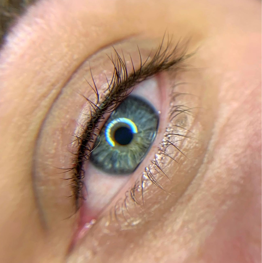 Wimpernkranzverdichtung