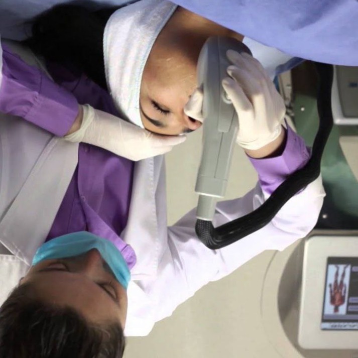 Крио RF лифтинг (лицо)