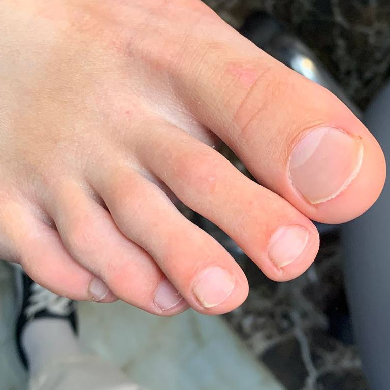 ПОЛНОЕ СНЯТИЕ + ПЕДИКЮР