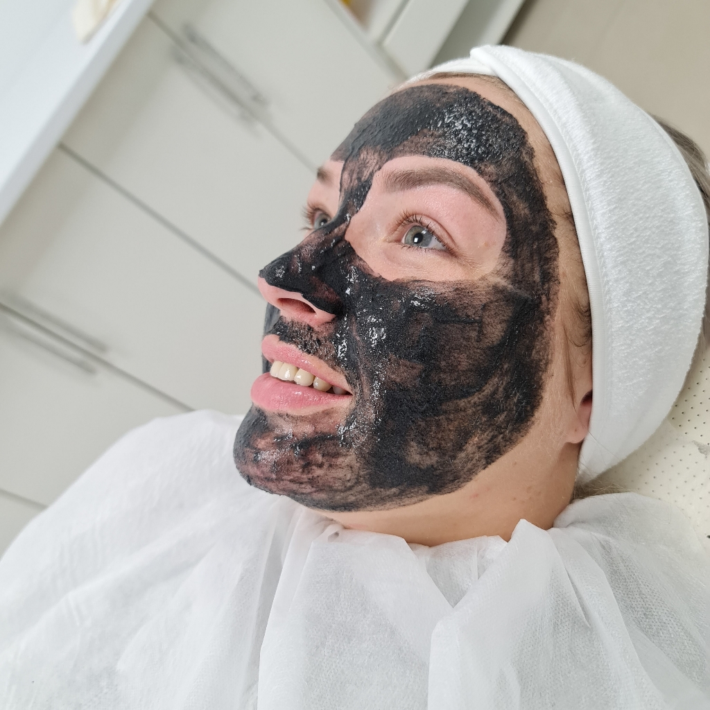 Карбоновый пилинг