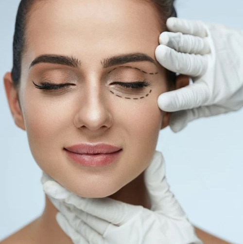 SMAS LIFTING  глаза