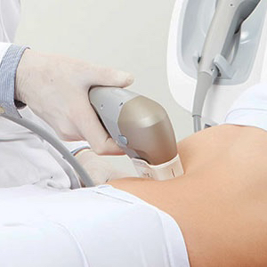 SMAS LIFTING тело из расчёта площади формата А4