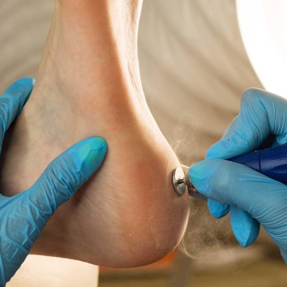 Педикюр гигиенический без покрытия: стопы и пальцы