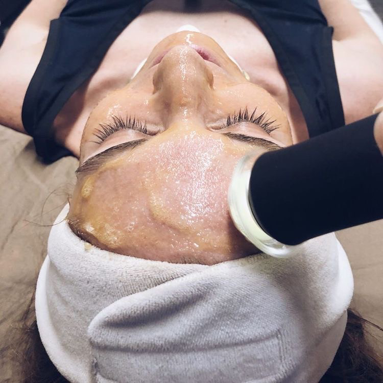 RF ЛИФТИНГ ЛИЦА