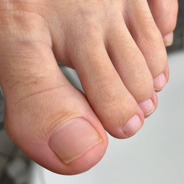 Снятие покрытия и обработка ногтей на ногах