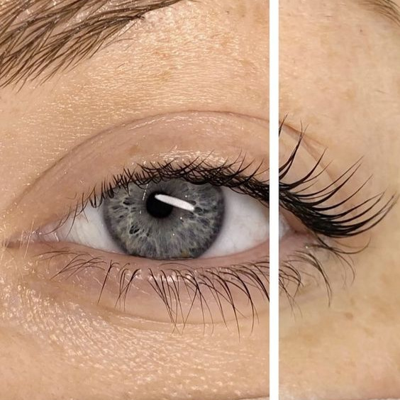 Ботокс ресницы