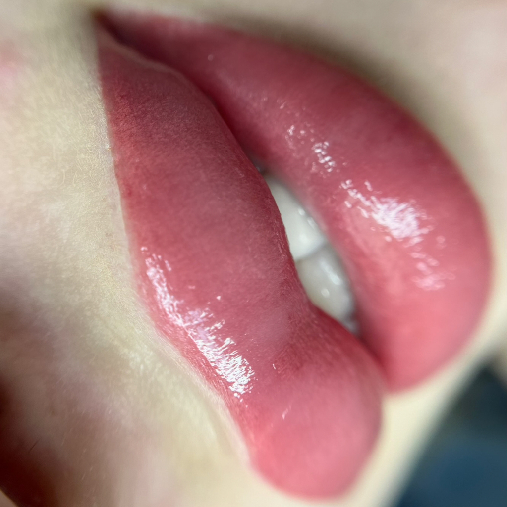 Коррекция пм губ