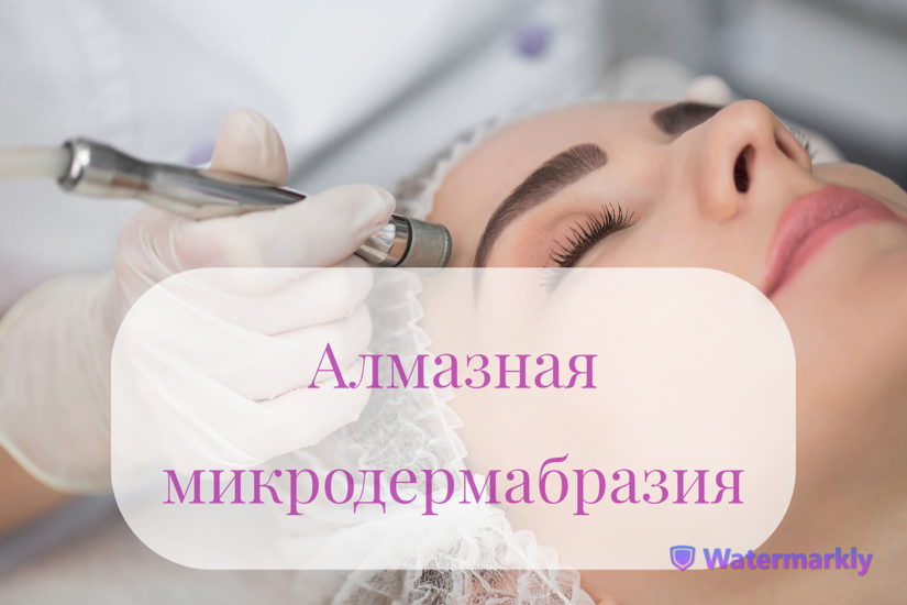 Алмазная микродермабразия ( микрошлифовка )