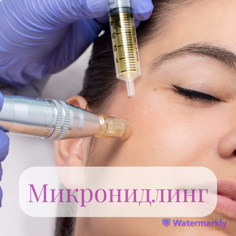 Фракционная мезотерапия с сывороткой