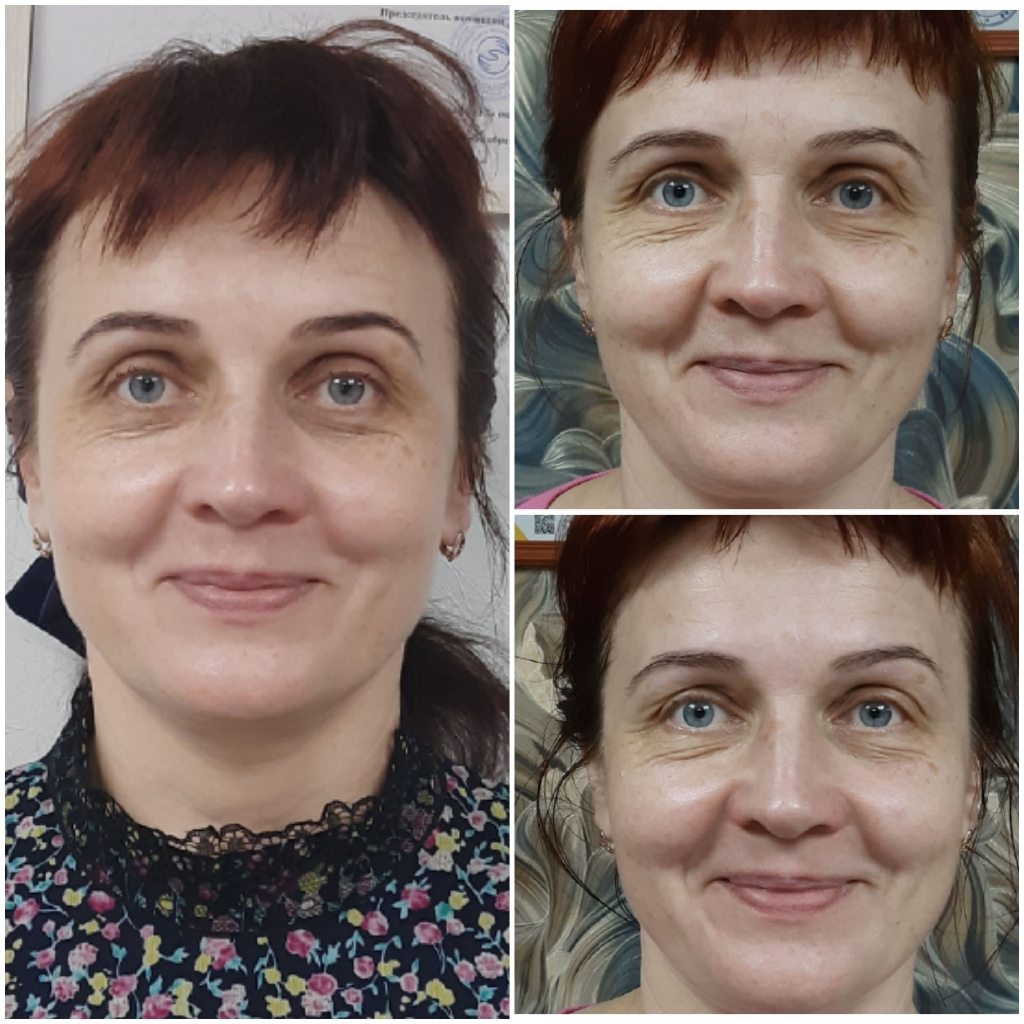 Массаж лица
