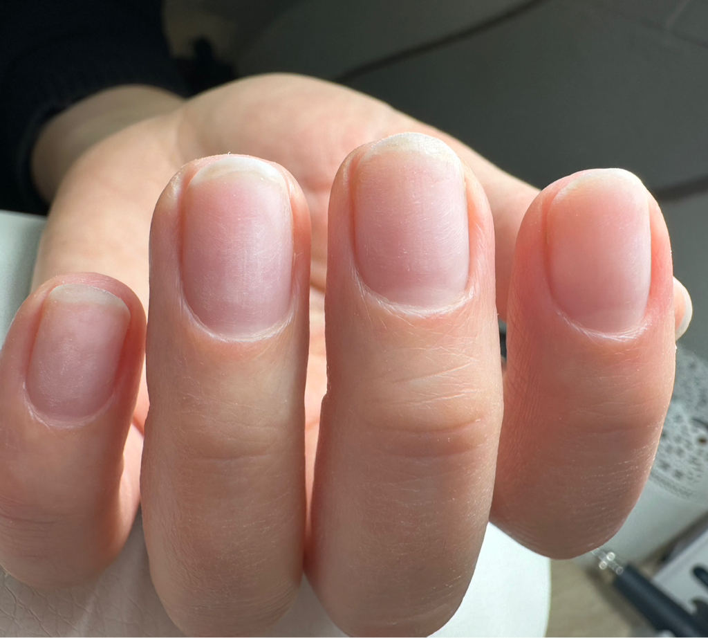 Укрепление IBXсистемой