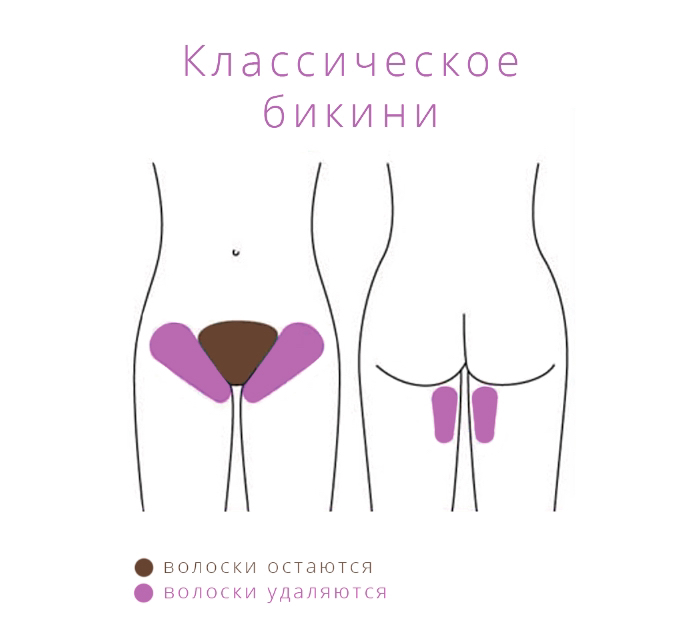 БИКИНИ КЛАССИКА.                                                      (шугаринг)