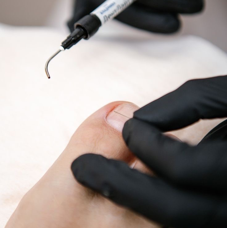 Переустановка КС ТН