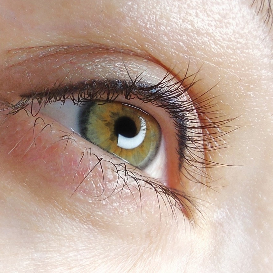 межресничка ( первая процедура)