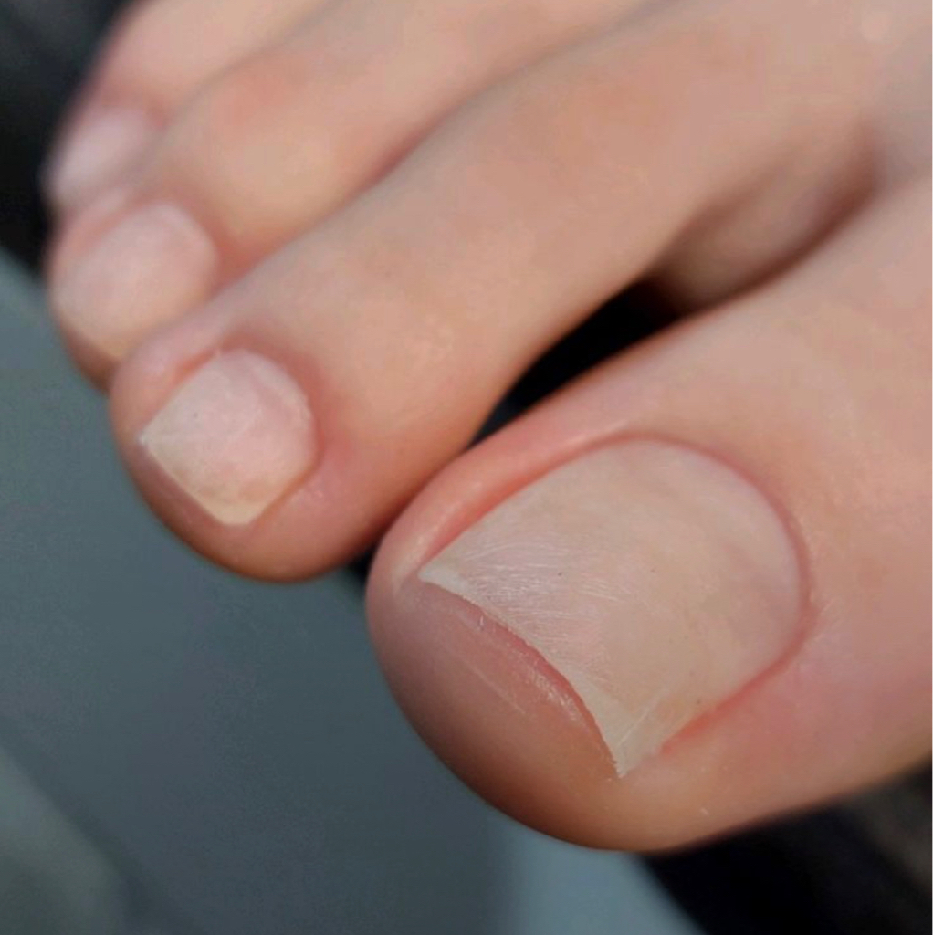 Педикюр гигиенический