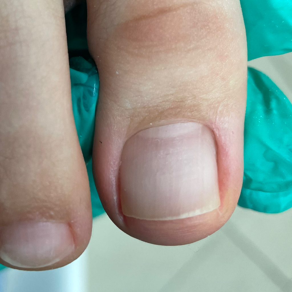 Обработка пальчиков (без покрытия)