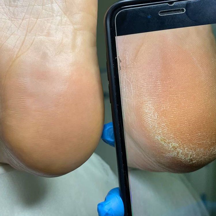 Смарт-педикюр без покрытия