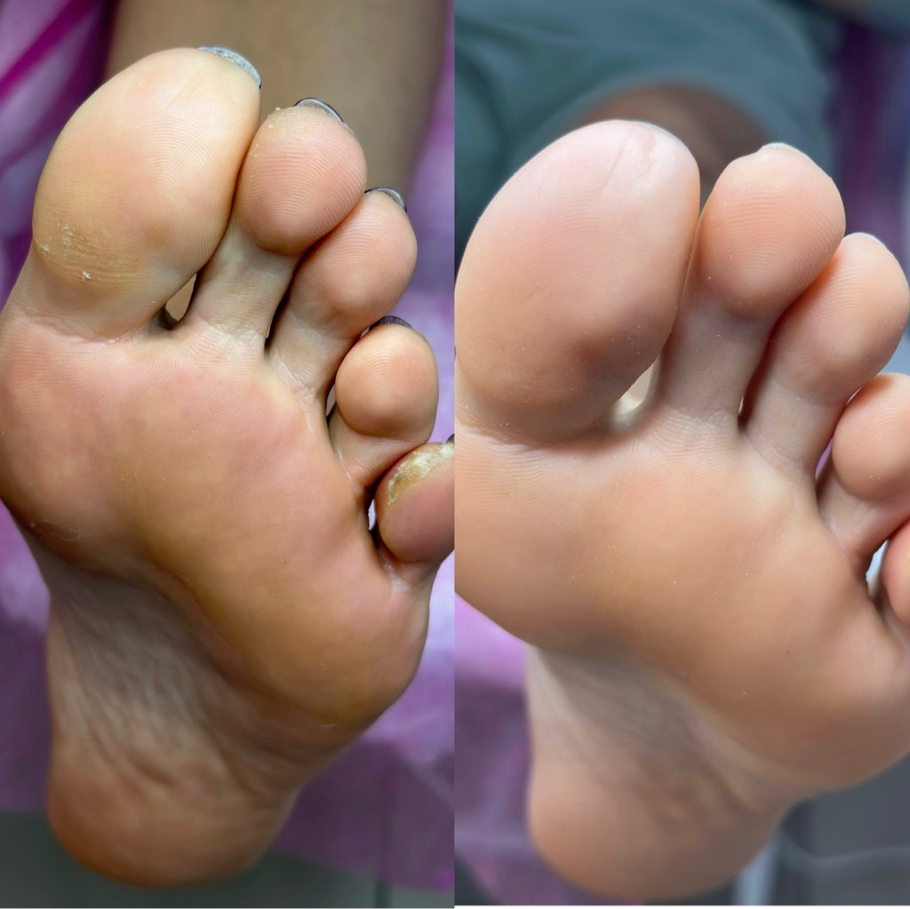 Педикюр с обработкой стоп с покрытием гель лак/ лак или без него за 1ч-1,30 мин